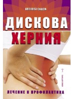 Дискова херния. Лечение и профилактика