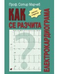 Как се разчита електрокардиограма