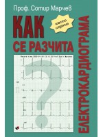 Как се разчита електрокардиограма