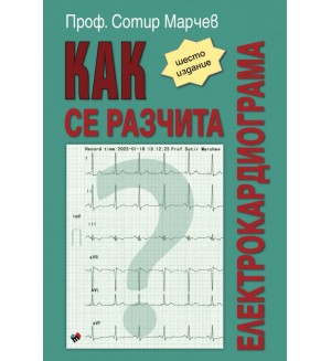Как се разчита електрокардиограма