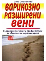 Варикозно разширени вени